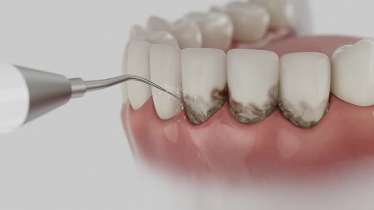 Trusted Teeth Cleaning And Checkup service in South Charleston, WV - Dentist Open Now